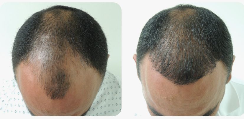 Before & After